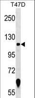 Polyclonal Rabbit anti-Human ZNF217 Antibody (aa92-120, WB)