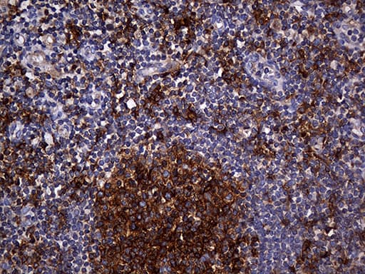 Monoclonal Mouse anti-Human CPM / Carboxypeptidase M Antibody (clone OTI4E11, aa124-423, IHC, WB)