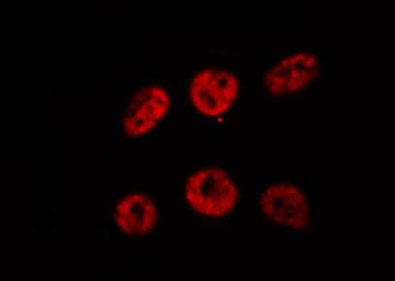 AML1 / RUNX1 Antibody
