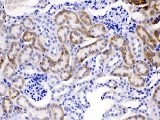 FACL2 / ACSL1 Antibody