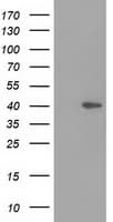 DNAJB1 / Hsp40 Antibody (clone OTI1F9, Carrier-free)