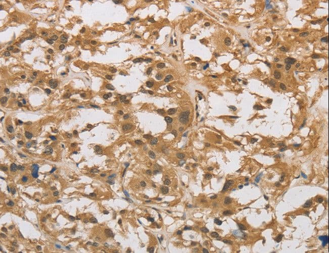 DAB2 Antibody
