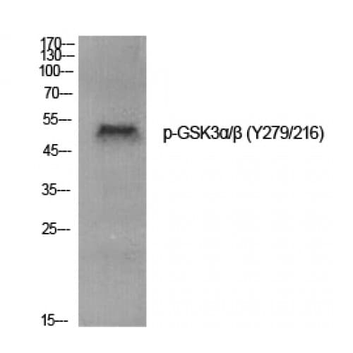 GSK3 Alpha+Beta Antibody (220-300 aa)