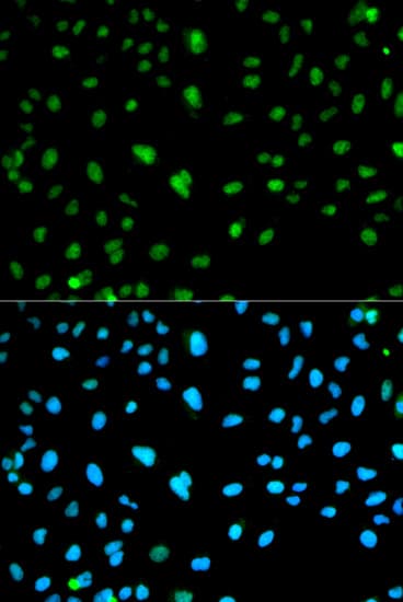 Polyclonal Rabbit anti-Human CA3 / Carbonic Anhydrase III Antibody (IHC, IF, WB)