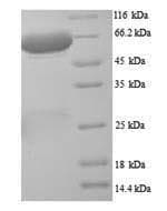 Rat PLBD2 Protein (Recombinant 6His, N-terminus)