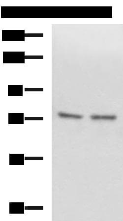 Polyclonal Rabbit anti-Human SCMH1 Antibody (IHC, WB)