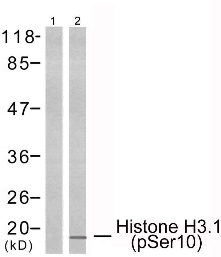 Histone H3.1 Antibody (phospho-Ser10)