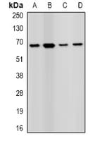 Polyclonal Rabbit anti-Human PRODH Antibody (IHC, WB)