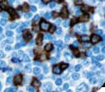PDCD1 / CD279 / PD-1 Antibody (clone NAT-105)