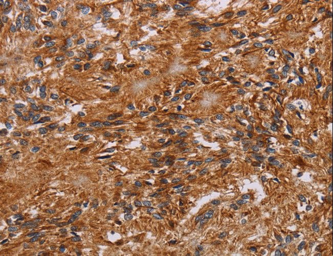 Polyclonal Rabbit anti-Human JAKMIP2 Antibody (IHC)