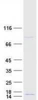 Human C9orf170 Protein (Recombinant Myc-DDK (Flag))