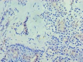 RD / PHYH Antibody (aa1-338)