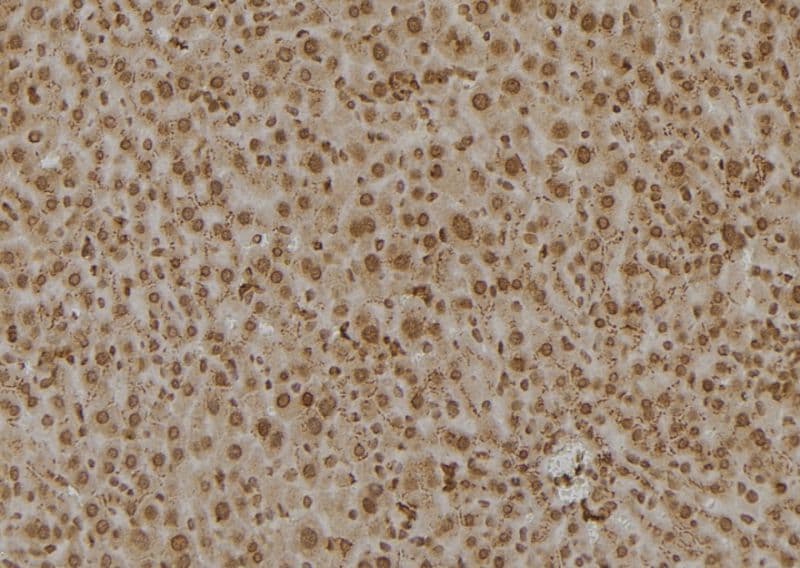 PSMC6 Antibody