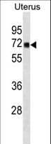 TRMT1 Antibody (aa87-114)
