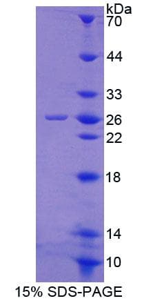 Rat GPX6 / GPX-6 Protein (Recombinant His-T7, N-terminus)