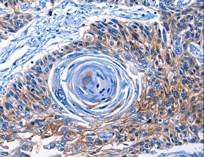 CLEC2B / AICL Antibody