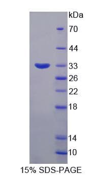 Human SYTL2 / SLP2 Protein (Recombinant His-S)