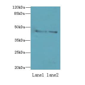 Dynactin 2 / Dynamitin Antibody