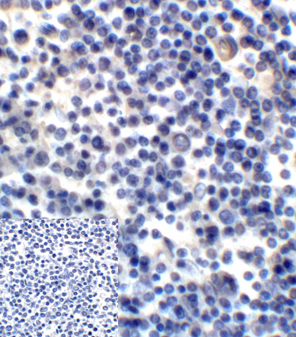 CD276 / B7-H3 Antibody (clone 2H5)