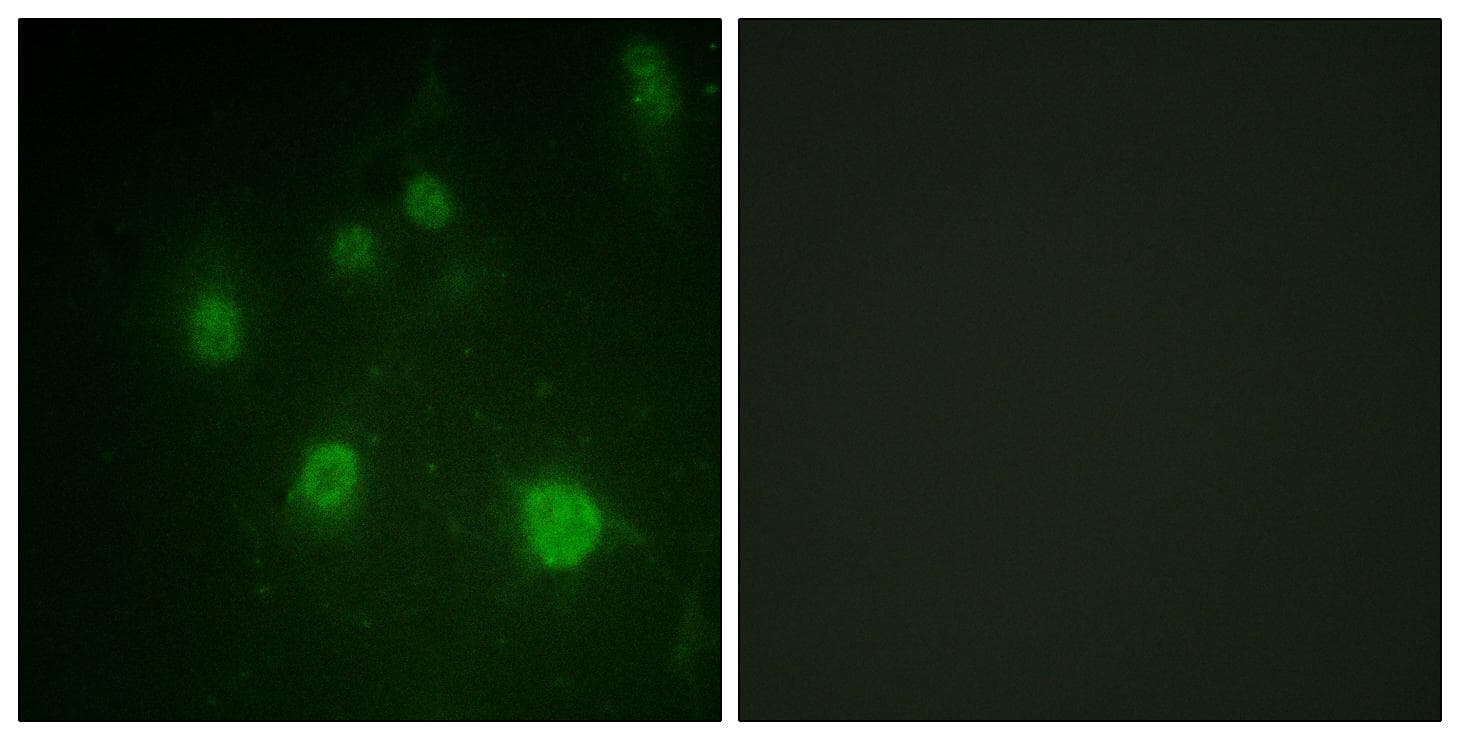 HMGN1 / HMG14 Antibody (phospho-Ser21)