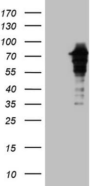 ZNF449 Antibody (clone OTI2C5)