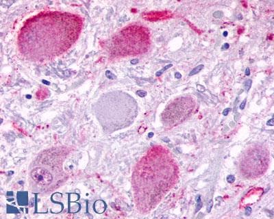 PathPlus™ ADGRB3 / BAI3 Antibody (C-Terminus)
