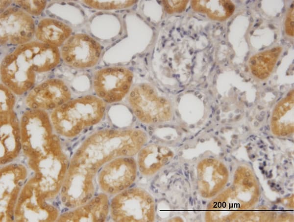 Monoclonal Mouse anti-Human SORD / Sorbitol Dehydrogenase Antibody (clone 4D3, IHC, WB)
