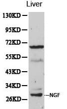 Polyclonal Rabbit anti-Human NGF Antibody (IHC, WB)
