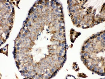 IDH1 / IDH Antibody