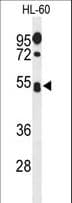 SPN / CD43 Antibody (aa226-253)