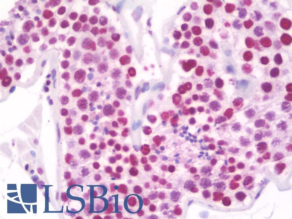 IHC-plus™ Polyclonal Rabbit anti-Human RANBP6 Antibody (aa800-849, IHC, WB)