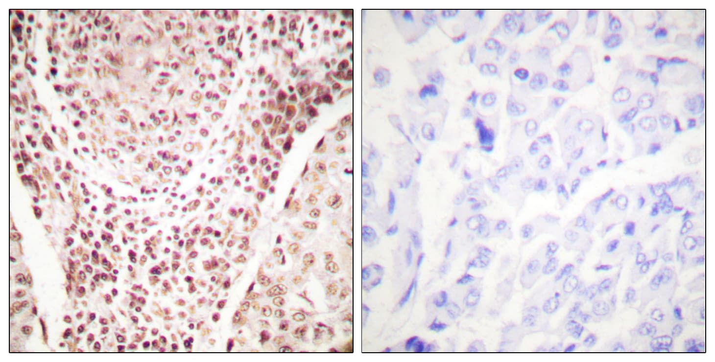 CHEK2 / CHK2 Antibody (phospho-Thr387)