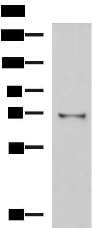 Polyclonal Rabbit anti-Human GSTCD Antibody (IHC, WB)