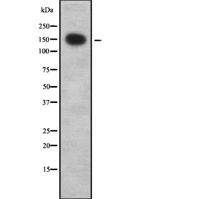 YEATS2 Antibody