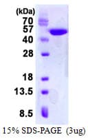 Human CKMT1A Protein (Recombinant His)