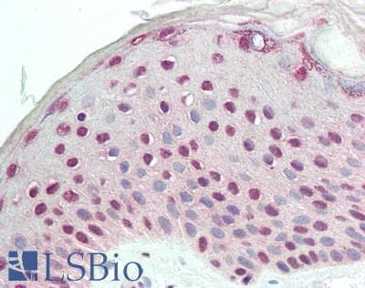 IHC-plus™ SMAD5 Antibody (C-Terminus, clone 4B10-B10-B6)