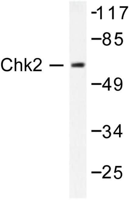 CHEK2 / CHK2 Antibody (Met381)