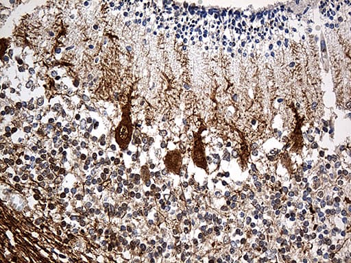 SH3BGR Antibody (clone OTI4G5)
