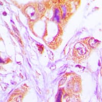 Polyclonal Rabbit anti-Human FADD Antibody (Internal, IHC, IF, WB)