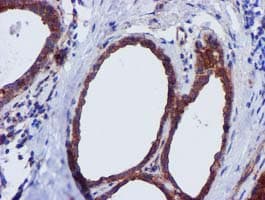 EPN2 Antibody (clone OTI1C5, Carrier-free)