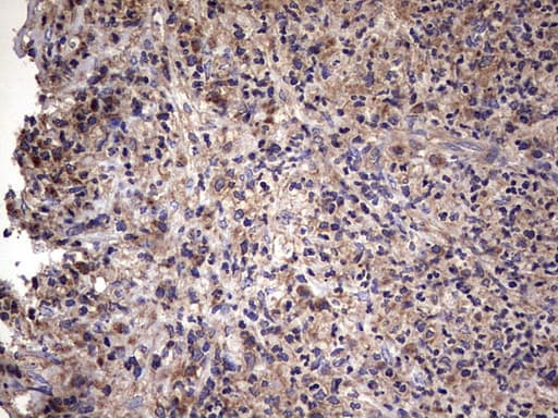 IL1RN Antibody (clone OTI2B1)