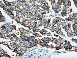 KHK / Ketohexokinase Antibody (clone OTI1D8)