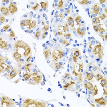 FECH / Ferrochelatase Antibody