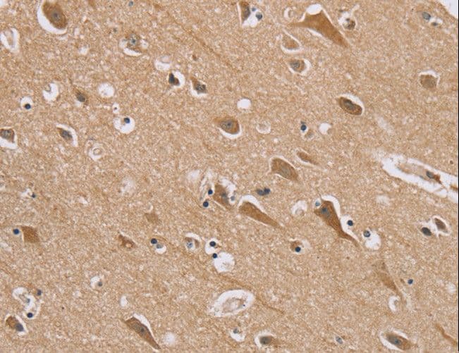 RAB6C Antibody