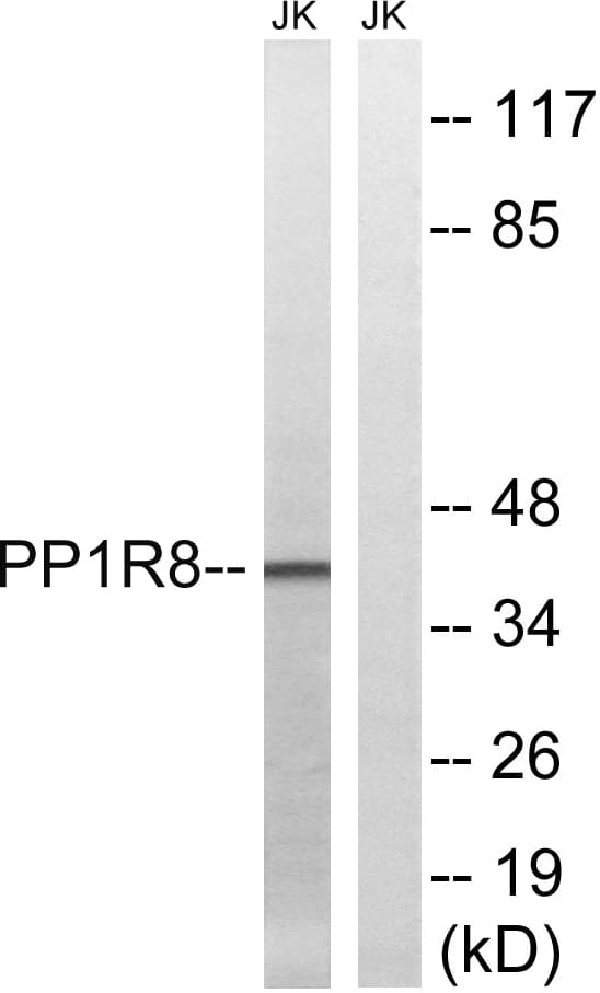 PPP1R8 / Rnase E Antibody (aa196-245)