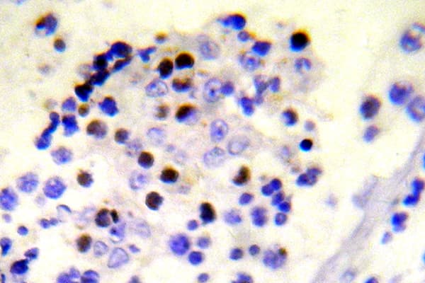 H2AFX / H2AX Antibody (phospho-Ser139)