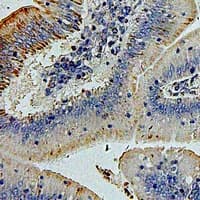MARVELD2 / Tricellulin Antibody