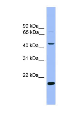 KLF4 Antibody (N-Terminus)