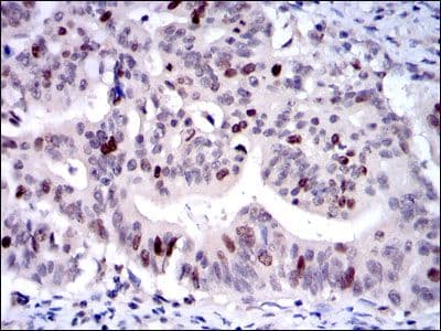 KIF22 / OBP Antibody (clone 5F3)