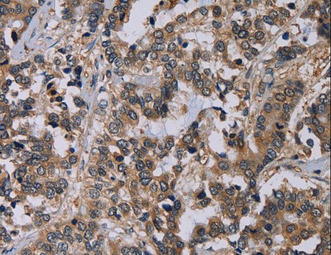 IHC-plus™ Polyclonal Rabbit anti-Human PVRL4 / Nectin 4 Antibody (aa371-510, IHC, WB)